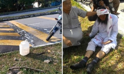 M'sian Injured From Motorbike Fall After He Encounters Suspicious Oil Slick on Selangor Road - WORLD OF BUZZ 2