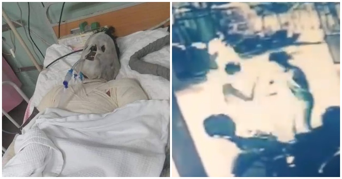 M'sian Man Sets Himself on Fire After Arguing with Girlfriend, Suffers 90% Burns to Body - WORLD OF BUZZ 1