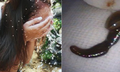 Woman Washes Face With Spring Water While Hiking, Leech Ends Up Slipping In Her Nose - WORLD OF BUZZ 1
