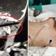 3yo Girl Gets Chopstick Pierced Through Her Skull As She Was Playing While Eating - WORLD OF BUZZ 2