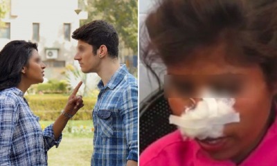 Ex-BF Viciously Bites Off Woman's Nose & Severely Injures Her After She Rejected Him Again - WORLD OF BUZZ 1