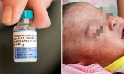 Over 20 Million Children Are Missing Their Measles Shots Every Year, Causing Outbreaks - WORLD OF BUZZ 3