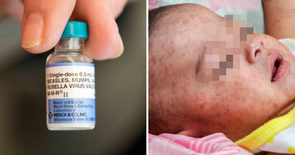 Over 20 Million Children Are Missing Their Measles Shots Every Year, Causing Outbreaks - WORLD OF BUZZ 3