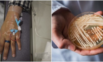 This Fungal Infection is Drug-Resistant, Can Kill You in 90 Days, and Has Spread Worldwide - WORLD OF BUZZ