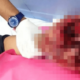 13yo Malaysian Boy Loses All 5 Fingers While Playing With Firecrackers During Ramadan - WORLD OF BUZZ 2