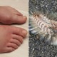 36yo Man's Left Leg Paralysed For Life After He Was Stung By a Golden Fireworm in Pangkor - WORLD OF BUZZ 2