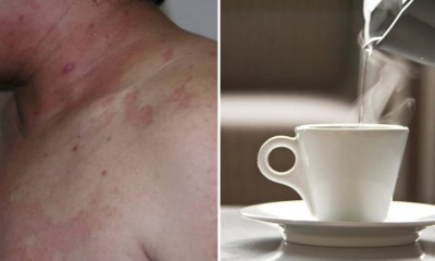 66yo Father Arrested For Scalding His Son With Boiling Water After Arguing Over RM30k Insurance Money - WORLD OF BUZZ 2