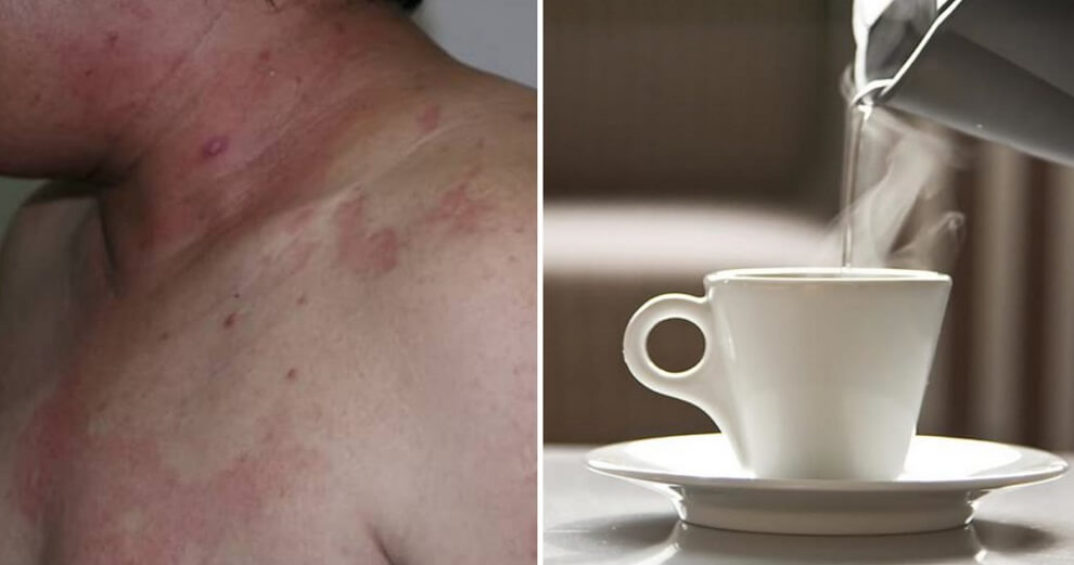 66yo Father Arrested For Scalding His Son With Boiling Water After Arguing Over RM30k Insurance Money - WORLD OF BUZZ 2