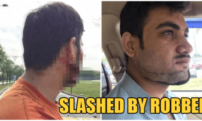 Foreign Worker Brutally Slashed in the Face by Robbers on Motorcycles in Shah Alam - WORLD OF BUZZ