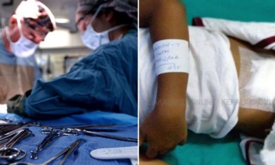 Doctor Mixes Patients up & Accidentally Performs Hernia Surgery on 7yo Boy Who Needed Nose Surgery - WORLD OF BUZZ 3
