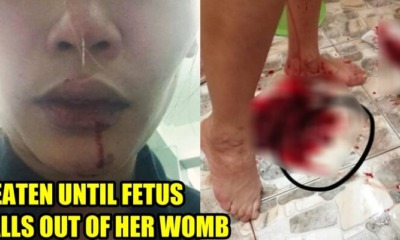 Husband Beats Wife Until Her She Miscarriages and Her Fetus Falls Out - WORLD OF BUZZ