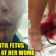 Husband Beats Wife Until Her She Miscarriages and Her Fetus Falls Out - WORLD OF BUZZ