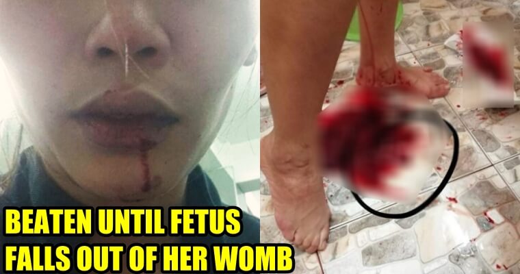 Husband Beats Wife Until Her She Miscarriages and Her Fetus Falls Out - WORLD OF BUZZ