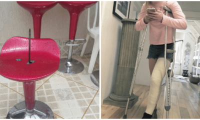 Woman Almost Dies After Metal Rod From Faulty Chair Pierces Her Leg - WORLD OF BUZZ