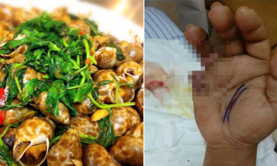 Women Eat Seafood Contaminated With Flesh-Eating Bacteria, Succumb to Organ Failure - WORLD OF BUZZ