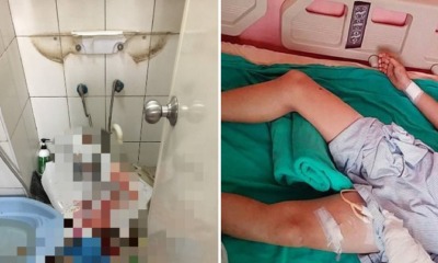 10yo Boy Seriously Injured & Severs 8 Nerves After Toilet Sink He Was Pressing On Suddenly Fell Off - WORLD OF BUZZ 4
