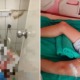 10yo Boy Seriously Injured & Severs 8 Nerves After Toilet Sink He Was Pressing On Suddenly Fell Off - WORLD OF BUZZ 4