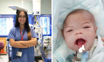 Baby Ainul To Recover After 200g Tumour Successfully Removed Thanks To Dr Amalina - WORLD OF BUZZ 1