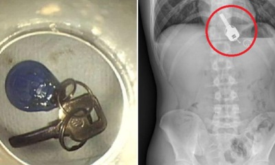 Man Gets So Drunk He Lost His Keys, Turns Out He Swallowed Them Instead - WORLD OF BUZZ 2