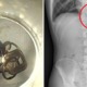 Man Gets So Drunk He Lost His Keys, Turns Out He Swallowed Them Instead - WORLD OF BUZZ 2