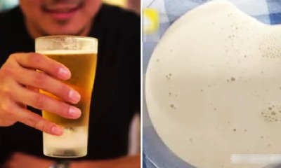 This Man Loves to Drink Beer Every Day Until Doctor Extracted Thick White Fluid From Swollen Knee Joint - WORLD OF BUZZ 4