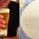 This Man Loves to Drink Beer Every Day Until Doctor Extracted Thick White Fluid From Swollen Knee Joint - WORLD OF BUZZ 4