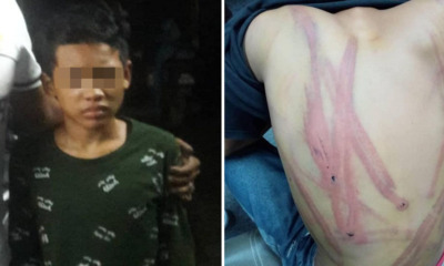 13yo Penang Boy Reportedly Beaten Up For Stealing Cigarettes, Parents File Police Report - WORLD OF BUZZ