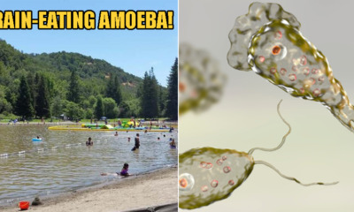 59yo Man Dies After Brain-Eating Organism Entered His Nose While Swimming at Water Park - WORLD OF BUZZ