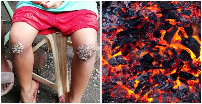 8yo Philippine Girl Forced to Kneel on Embers For Forgetting to Bring Her Bag Home - WORLD OF BUZZ 3