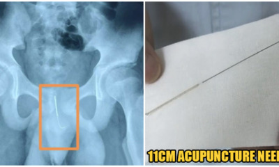 Boy Inserts 11CM Needle Into Urethra In Order To Stay Awake To Complete His Assignments - WORLD OF BUZZ 7