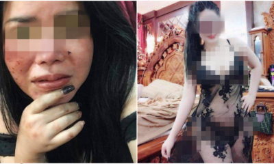 Lady Brutally Hit by Jealous Boyfriend For Posting Sexy Photos on Facebook - WORLD OF BUZZ
