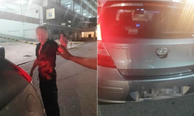 S'porean Driver Purposely Ran Over Passer-By's Feet In Johor Because He Blocked His Way - WORLD OF BUZZ