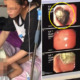 9yo Found to Have 18cm Diameter Hairball in Stomach After Mother Notices Her Balding - WORLD OF BUZZ