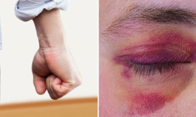 Jealous M'sian Wife Beaten, Slapped and Chased Out of Home by Husband Who Looked at Other Women - WORLD OF BUZZ