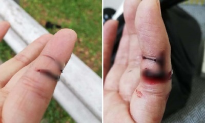 Malaysian Biker Warns Others After His Fingers Got Sliced By String Tied Around Flyover at DUKE Highway - WORLD OF BUZZ 3