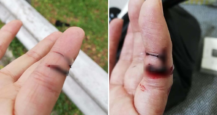 Malaysian Biker Warns Others After His Fingers Got Sliced By String Tied Around Flyover at DUKE Highway - WORLD OF BUZZ 3