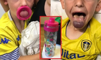 Mother Warns Others After 6yo Son Gets Tongue Stuck in Water Bottle Lid, Nearly Died - WORLD OF BUZZ 5