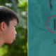 8yo Boy Shocked to Find 3 Broken Pieces of Sewing Needle in His Neck, No Clue How it Got There - WORLD OF BUZZ
