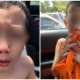 7yo Sarawakian Boy Punched In The Face By 8yo Peer, - WORLD OF BUZZ