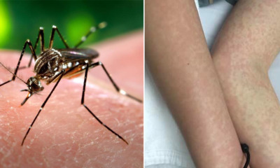 An Aedes Mosquito Can - WORLD OF BUZZ