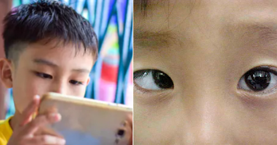 9yo Boy Becomes Cross-Eyed After Playing Mobile Games for 10 Hours Every Day During School Holiday - WORLD OF BUZZ