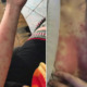 Woman Develops Severe Rash Due to an Imbalanced Immune Sys - WORLD OF BUZZ