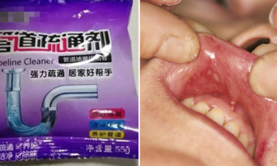 2yo Boy Eats Pipe Cleaning Powder So Mum Flushes Mouth With Water But Burns Him Instead - WORLD OF BUZZ