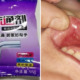 2yo Boy Eats Pipe Cleaning Powder So Mum Flushes Mouth With Water But Burns Him Instead - WORLD OF BUZZ