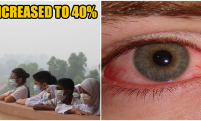 "40% Of Malaysians Are Sick Because of Haze!" Said MOH - WORLD OF BUZZ 1