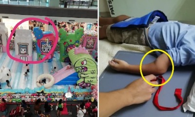 4yo Boy Fractures His Arm After Bully Pushes Him At Bouncy Castle in Johor Mall - WORLD OF BUZZ 2