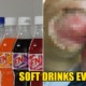 56yo M'sian Man Drank Soft Drinks Every Day, Gets Blistering Skin Infection & Almost Loses His Arm - WORLD OF BUZZ