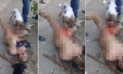 Gang Punishes Rapist By Stripping Him Naked & Allowing Dog to Tear Off His Genitals - WORLD OF BUZZ 5