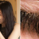 32yo Woman Did Not Remove Makeup Properly Found Mites in Her Eyelashes After Having Itchy & Dry Eyes - WORLD OF BUZZ