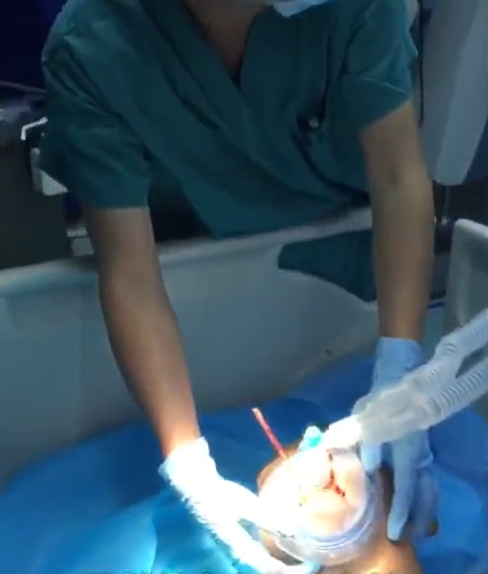 Nose4